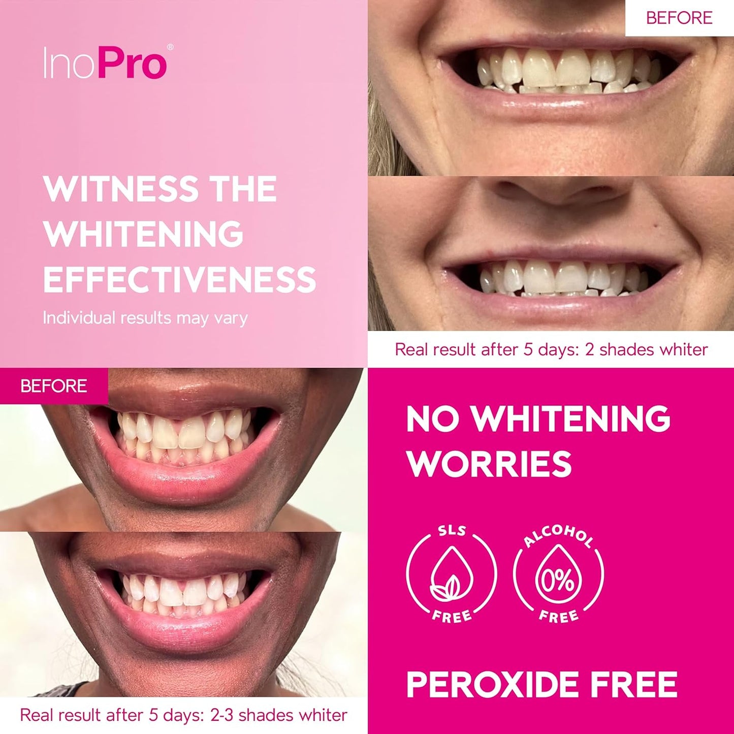 Teeth Whitening Strips 14 Treatments Kit - Teeth Whitener, Peroxide Free, Enamel Safe Green White Strips, Deep Stains Removal - Instant Teeth Whitening Without The Harm (28 Strips)